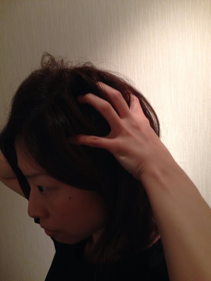 ベルシュヴー,抜け毛,頭皮