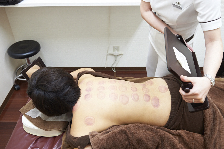 施術の様子