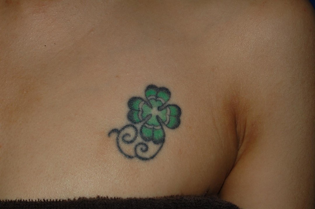 切除縫合術Before