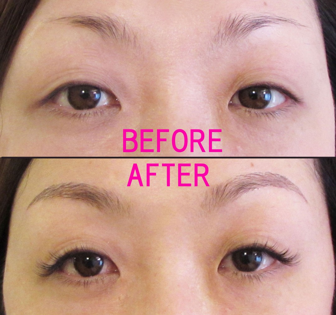 ビフォーアフター