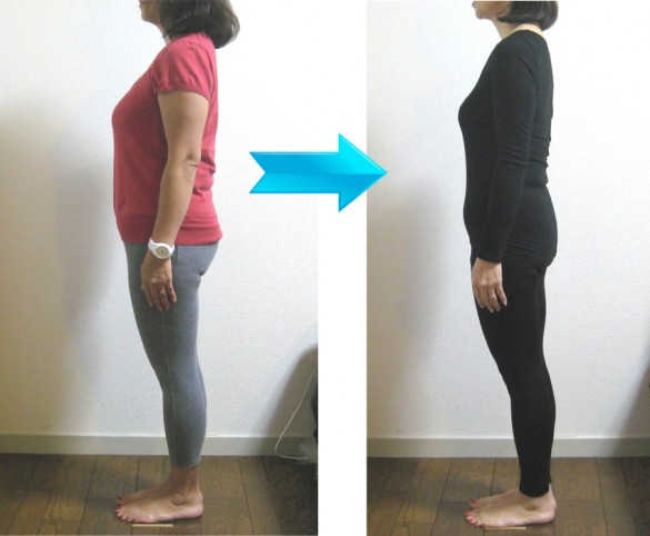 ビフォーアフター2 ビフォーアフター2