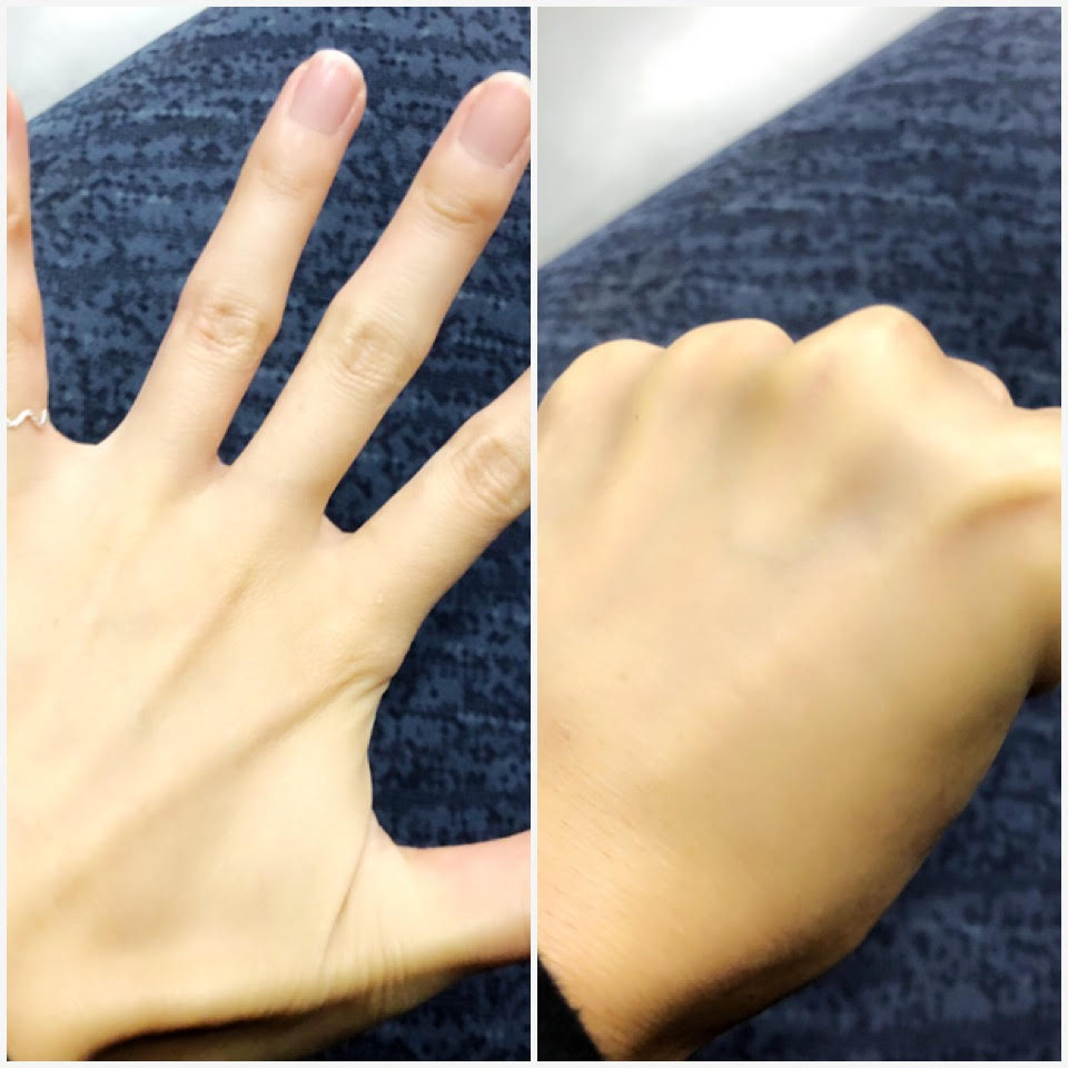 グー・パーの形に動かす