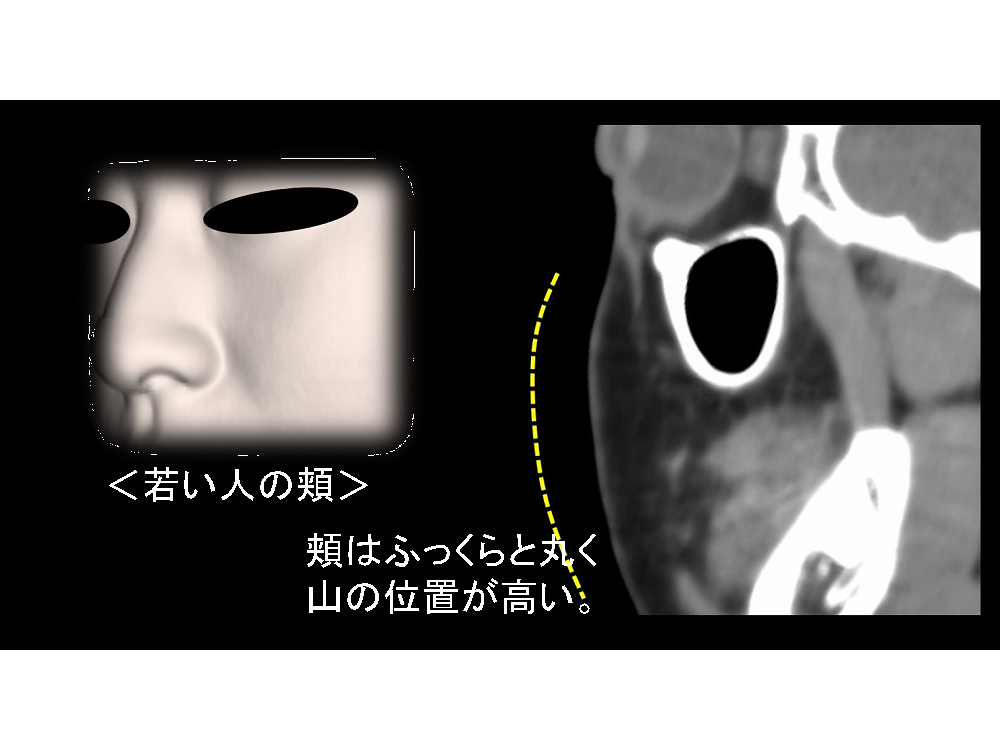 若い人の頬画像