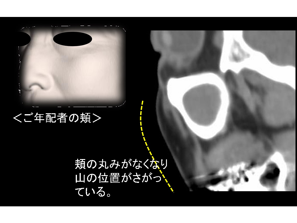 年配の人の頬画像
