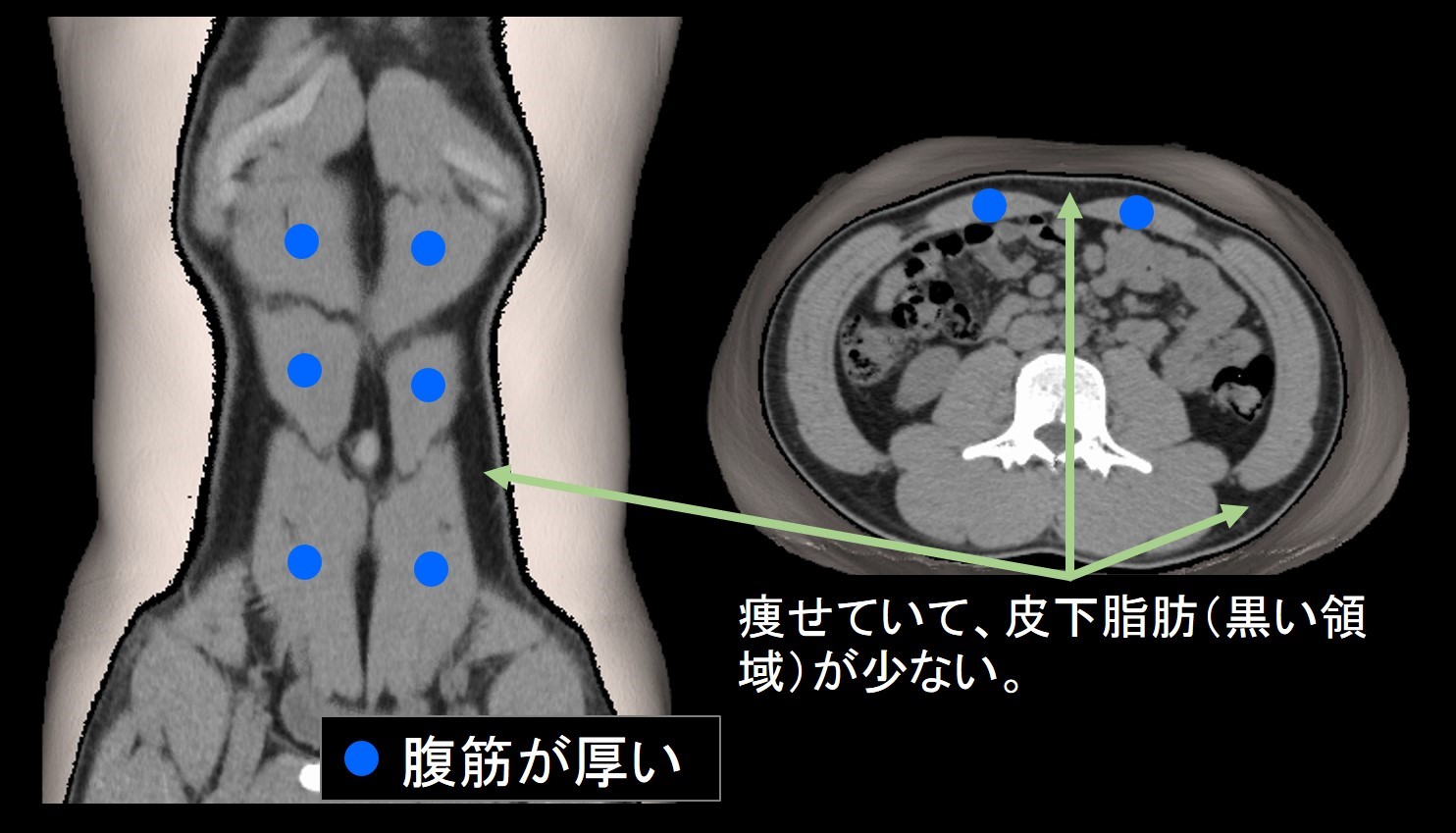 痩せた人のお腹画像