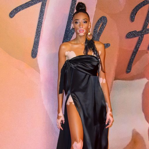 ウィニー・ハーロウ