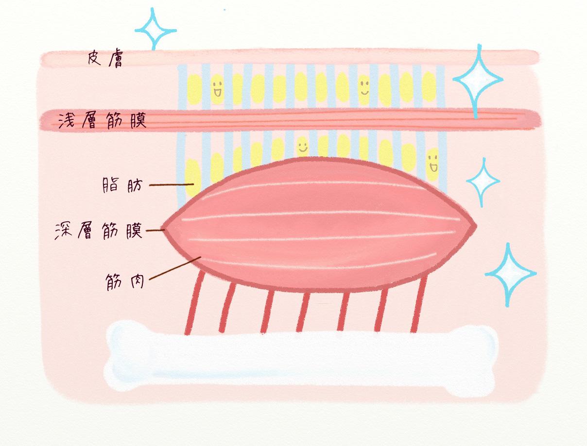 ゆがみが取れた状態