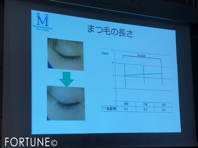 ふぉーちゅん・アイシャンプー