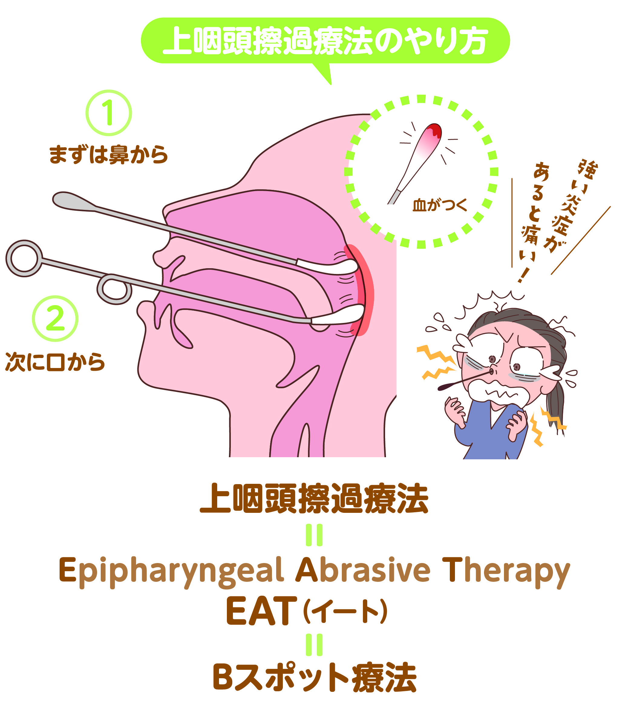 上咽頭擦過療法の仕組み