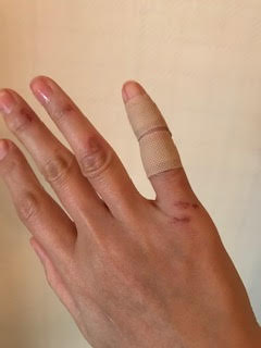 ケガから2日後の状態。出血は止まったが、かなり痛みが強いとのこと