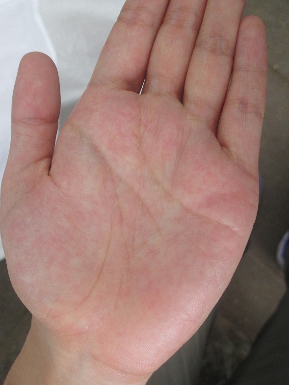 『ざんねんな手相』仕事が続かない男性の手相「飽き性線」