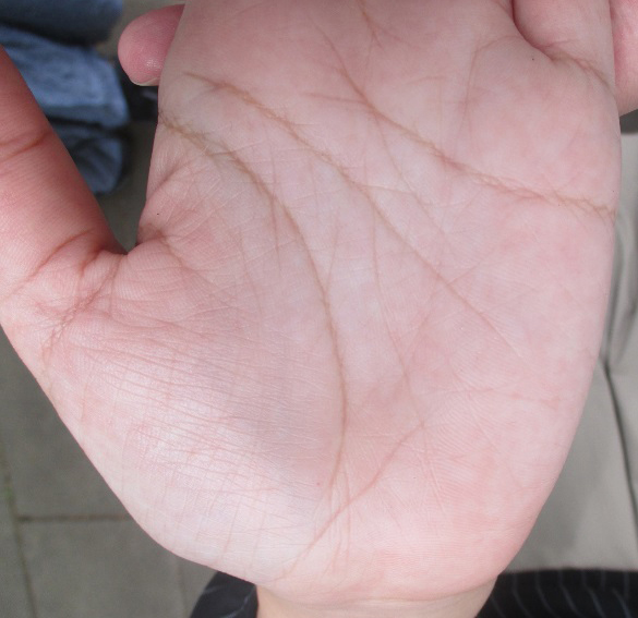 『ざんねんな手相』30代半ば・独身女性の手相「運命線と結婚線」