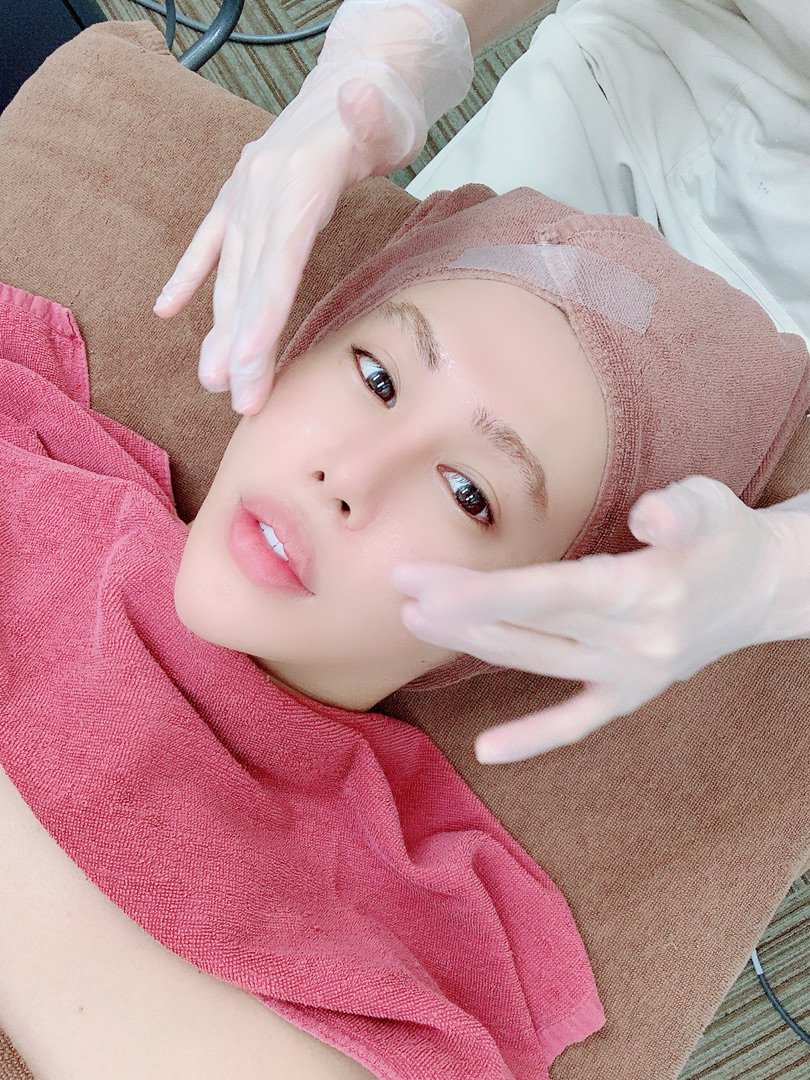 整形男子アレン