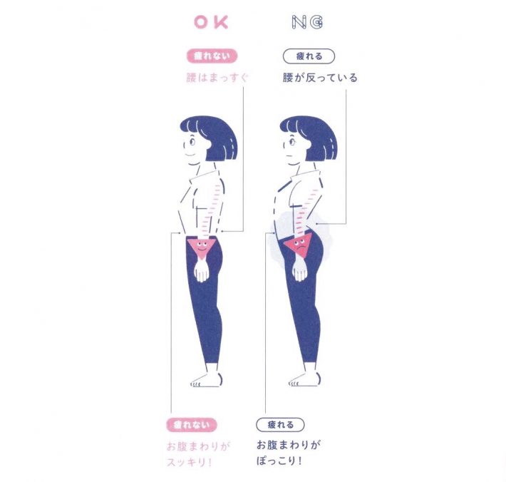 疲れない立ち方　反り腰の人