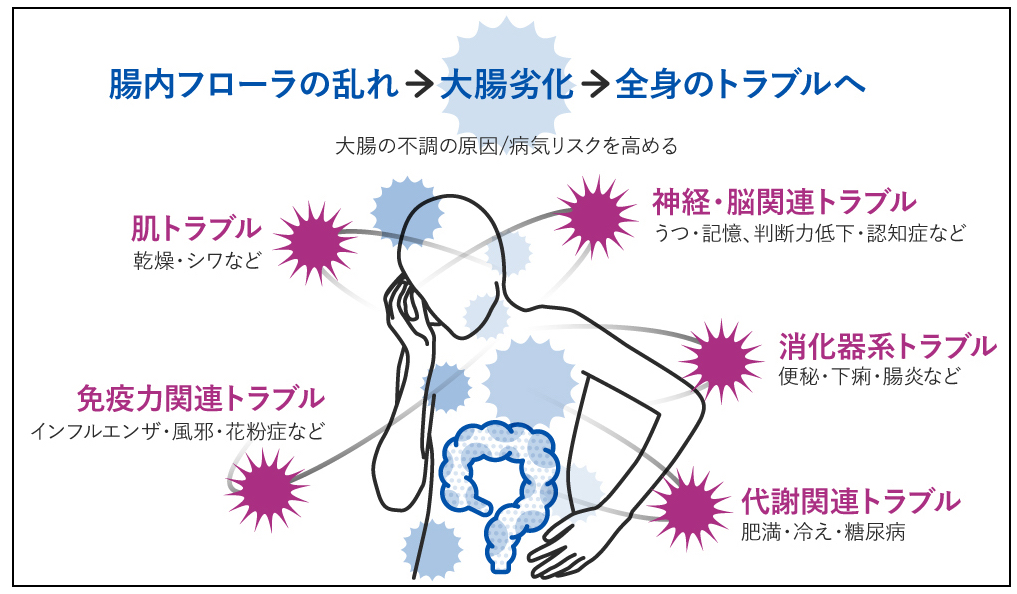 大腸劣化から全身のトラブルへ