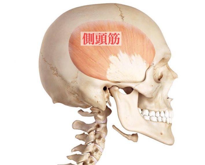 頭痛の原因は側頭筋だった