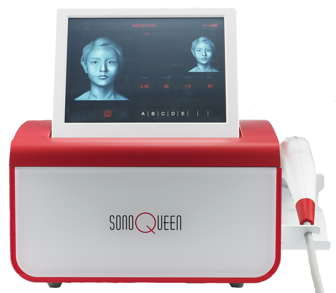 「ソノクイーン」