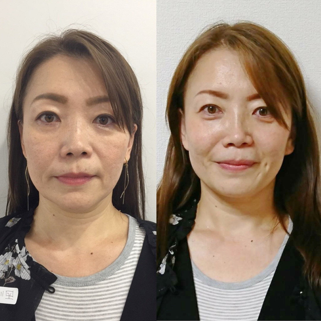 アシスタントさんのビフォーアフター