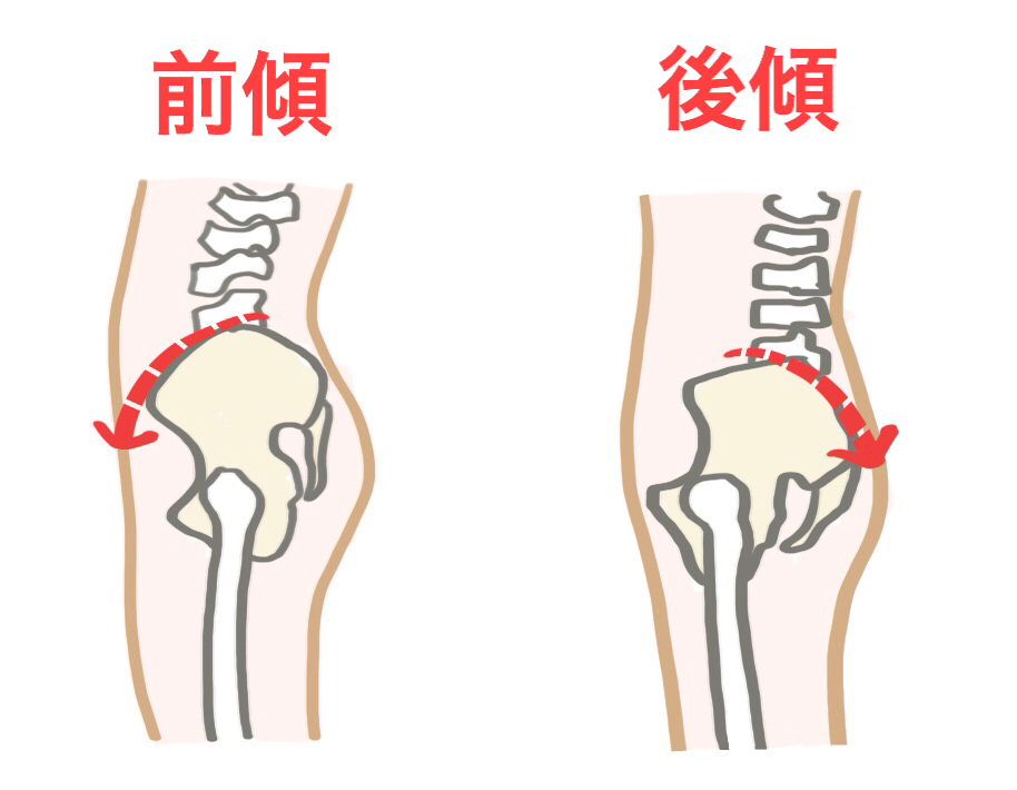 ヒップリフトのコツ、骨盤前傾・後傾の図