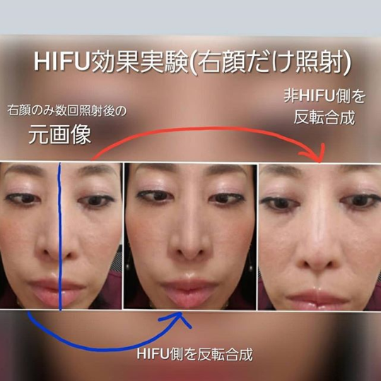 （画像：上原先生@eri.uehara Instagramより）