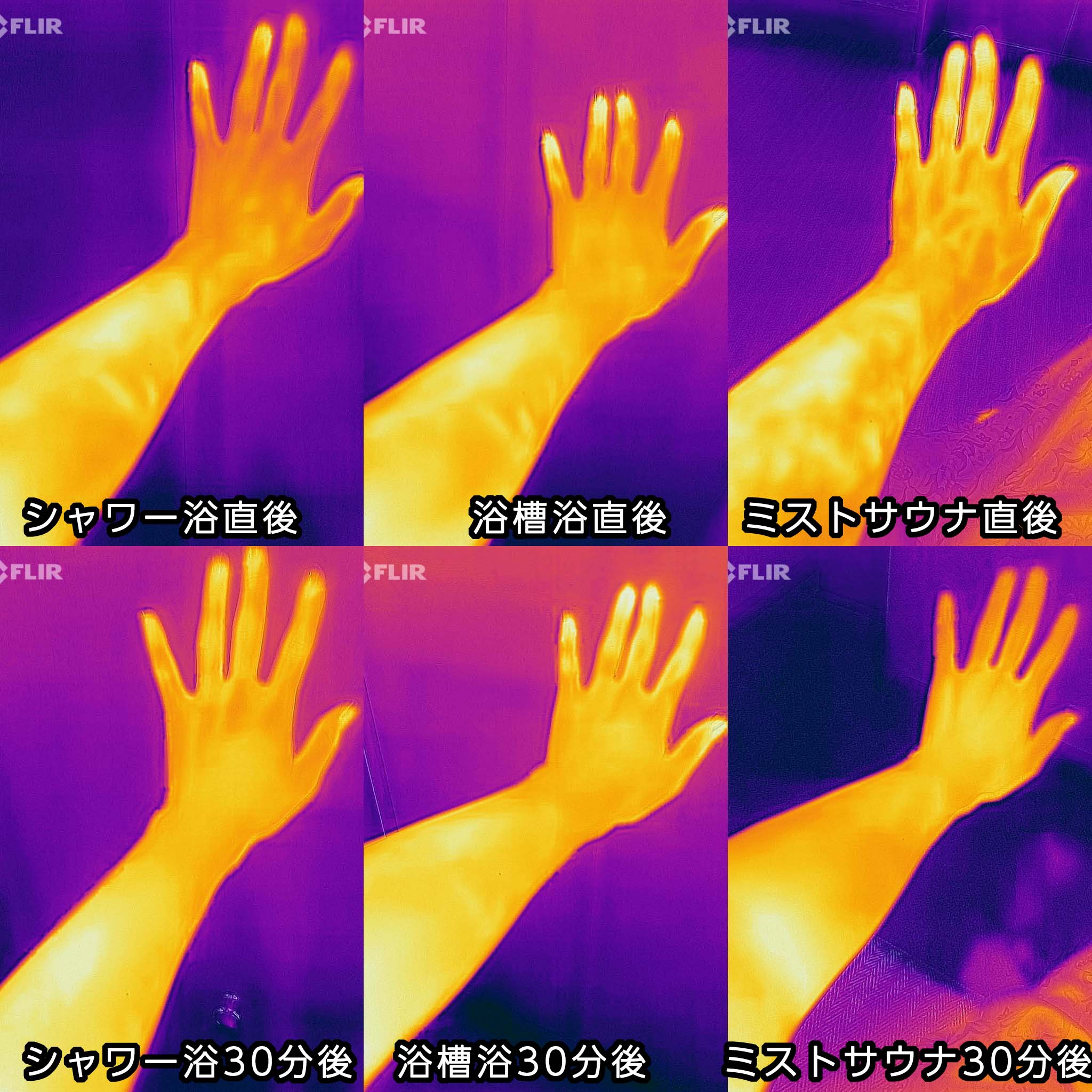 手パターンの30分後