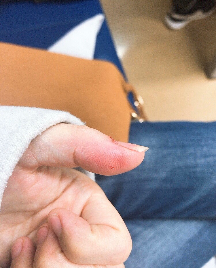 パスツレラ症　犬猫　病気