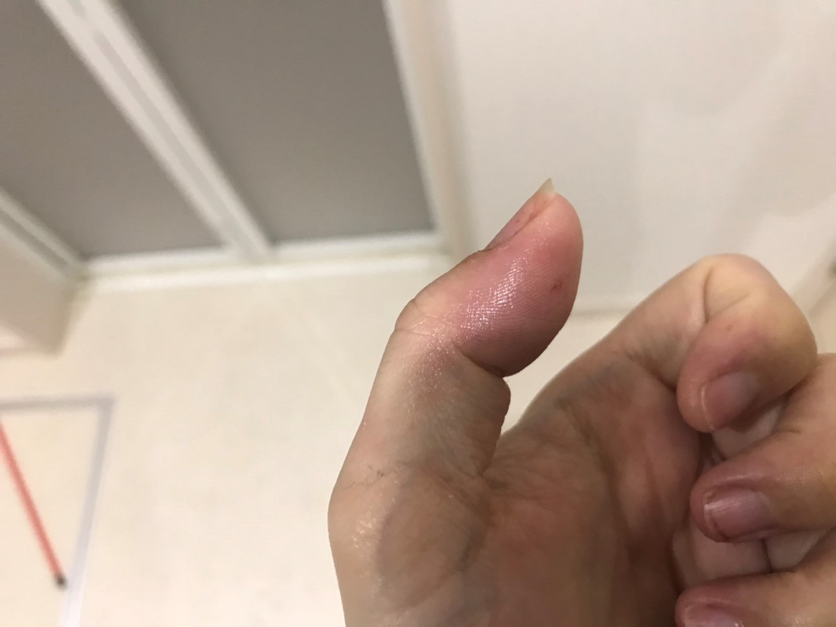 パスツレラ症　犬猫　病気