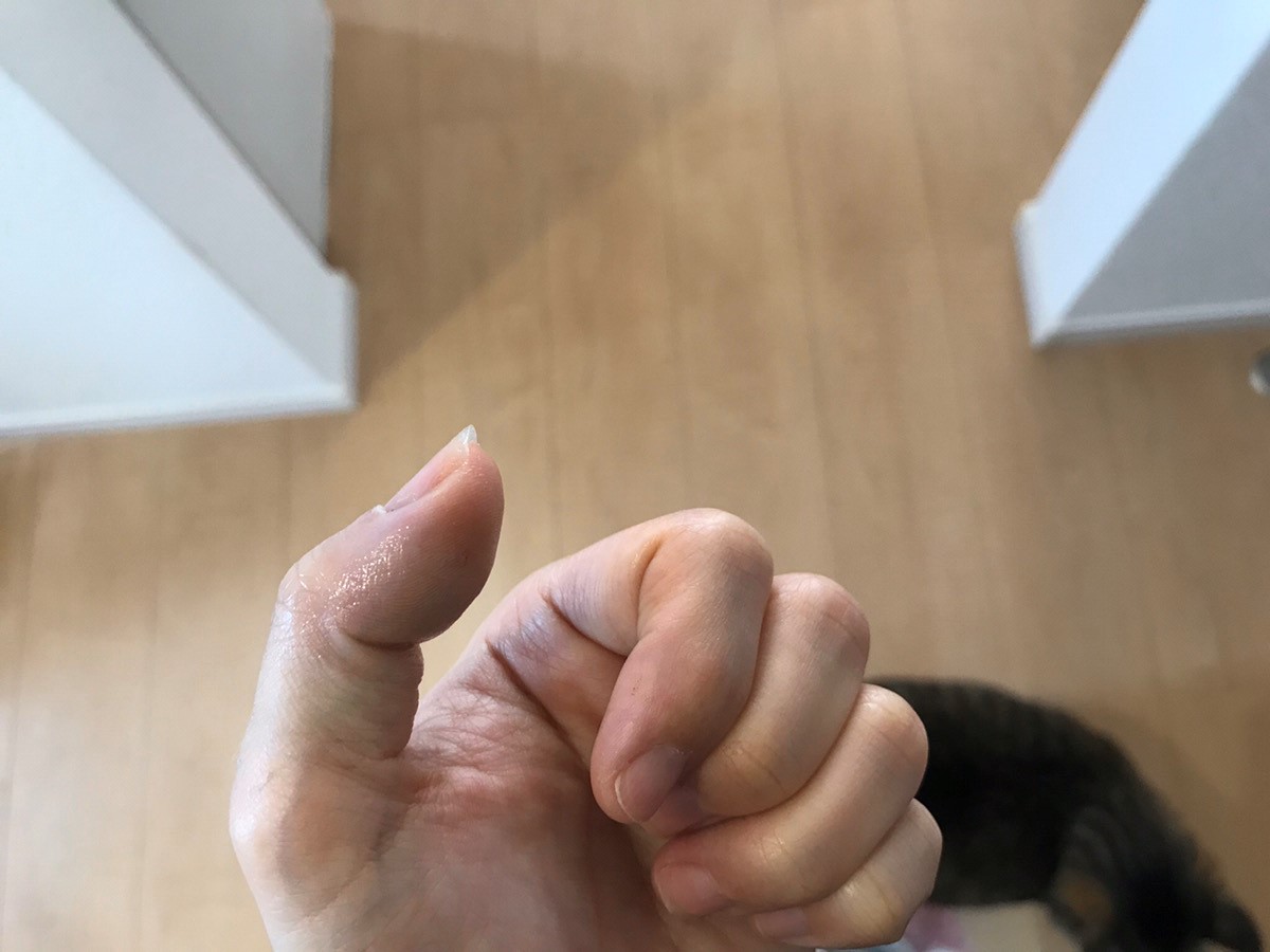 パスツレラ症　犬猫　病気