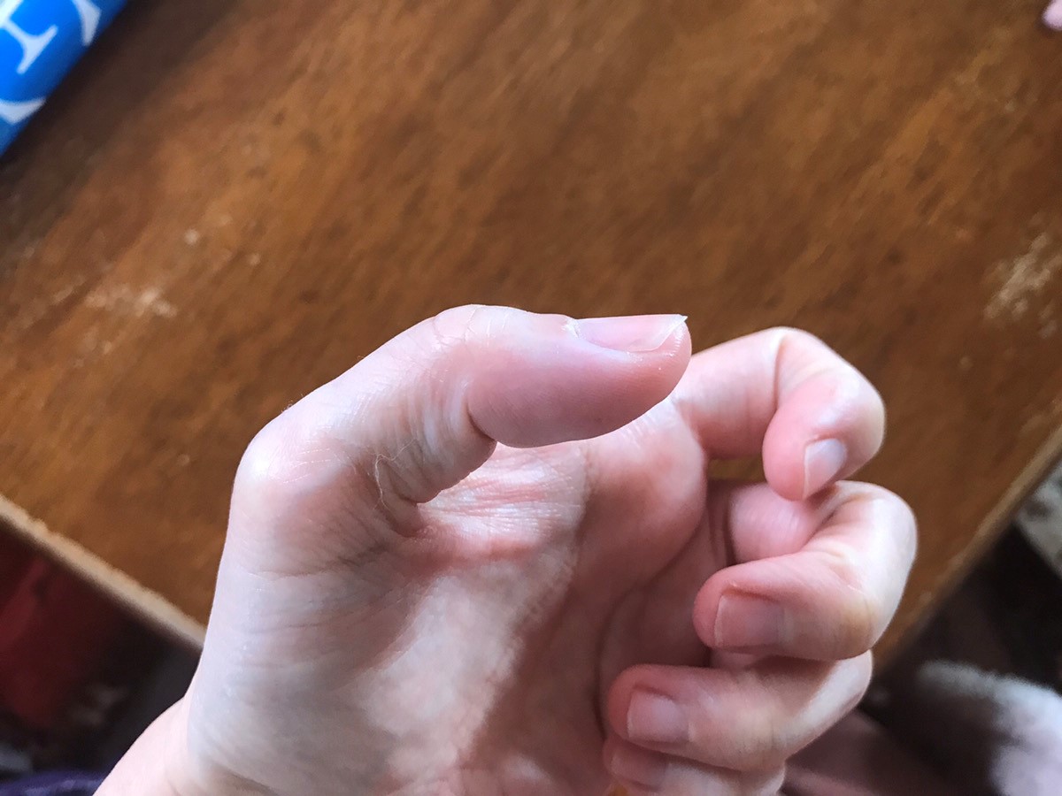 パスツレラ症　犬猫　病気