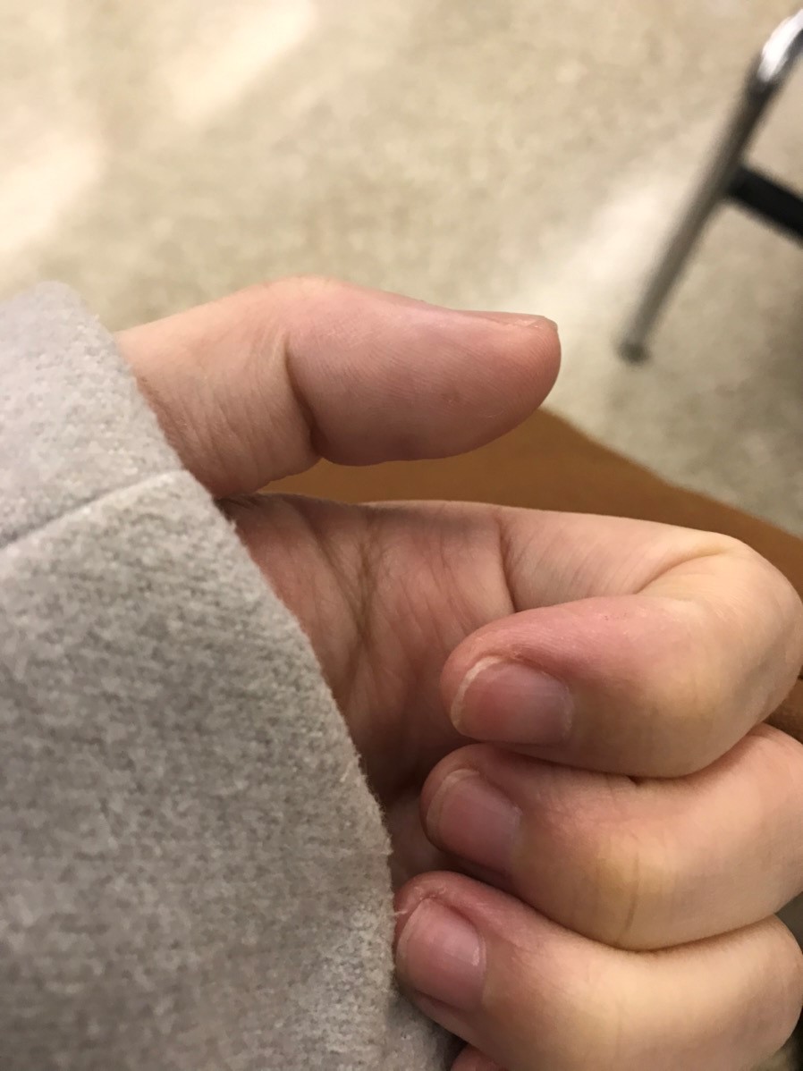 パスツレラ症　犬猫　病気