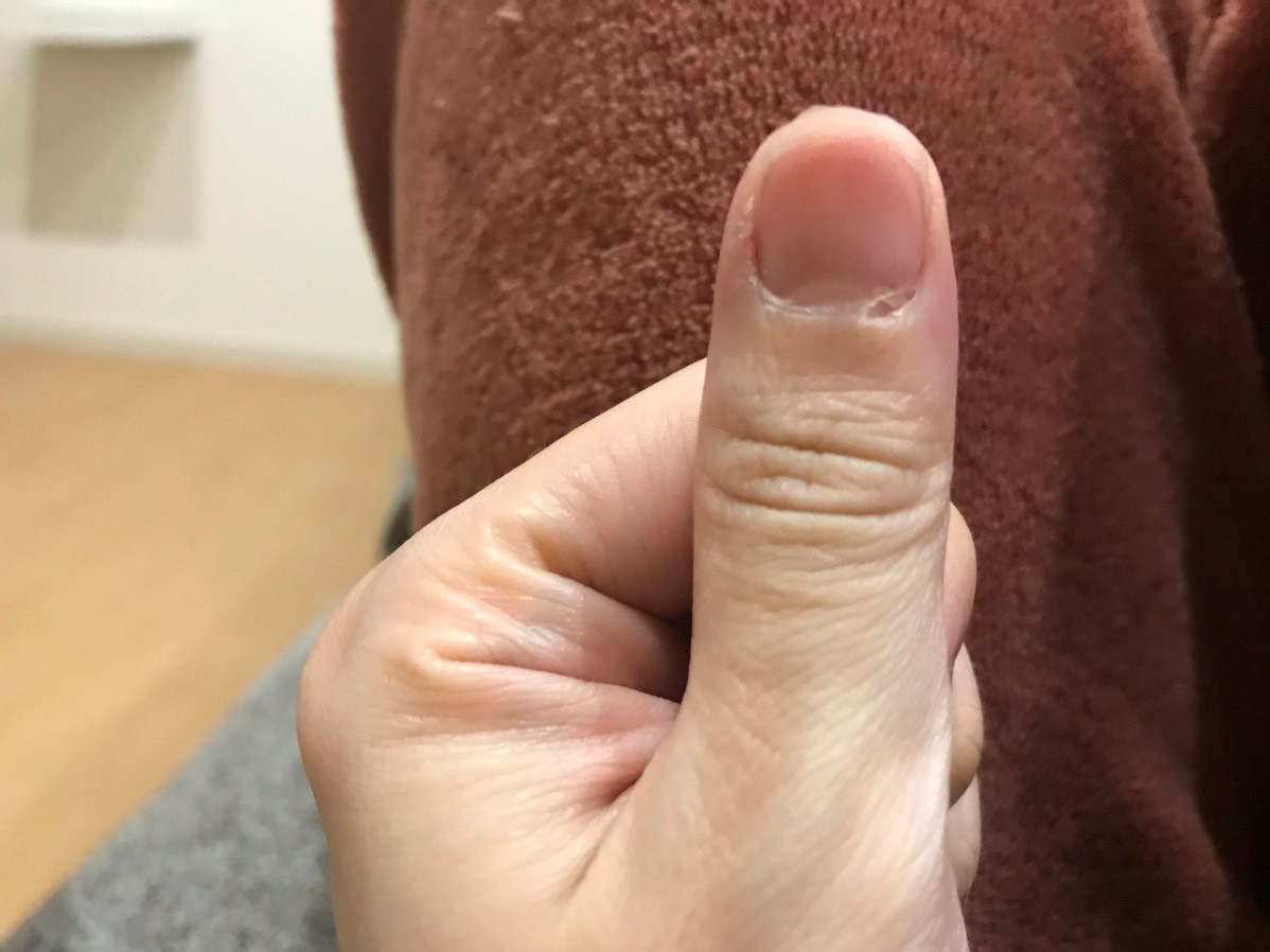 パスツレラ症　犬猫　病気