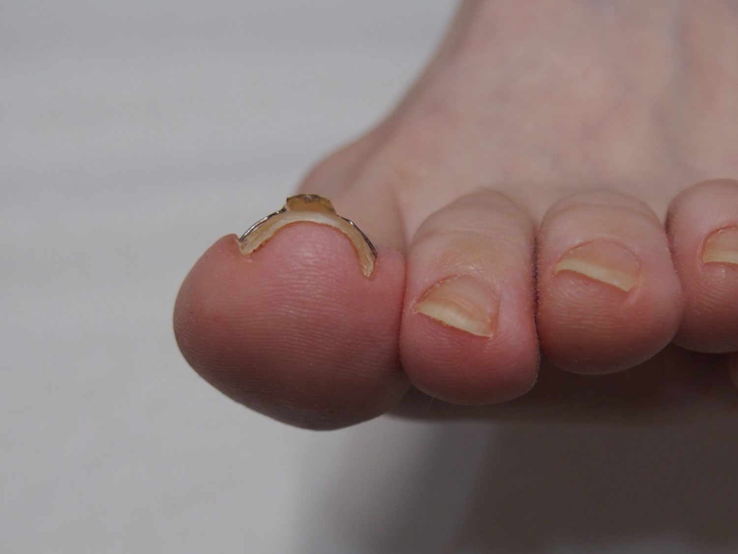 爪の食い込み感が改善されました