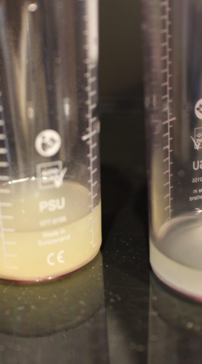 ハイドラフェイシャル12