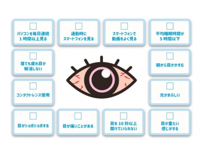 チェックリスト