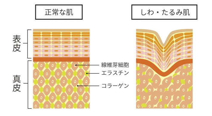 シワの仕組み