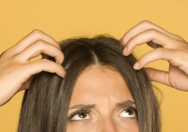 頭皮のかゆみやフケ