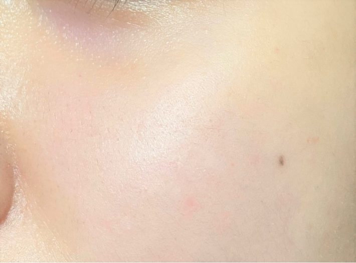 1カ月使ってみたらもっちり・きめ細やかな肌に