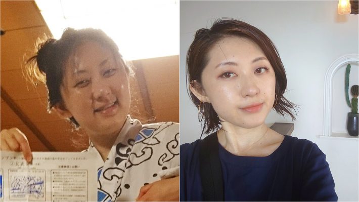 ビフォア・アフター