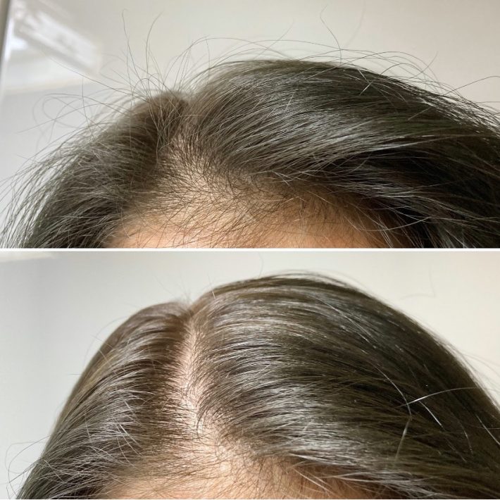 マトメージュを使った3時間後の状態