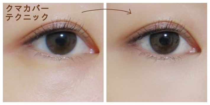 クマカバーテクニック