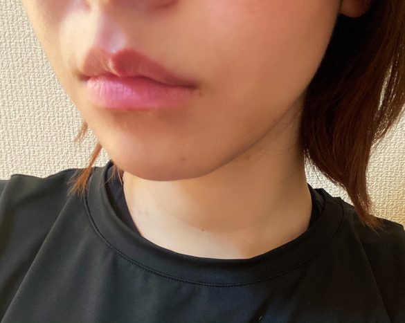 唇の縦じわが目立ってカサカサ