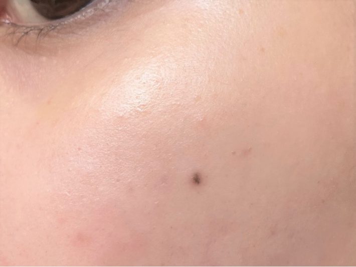 顔の産毛処理をしておくと透明感アップ！