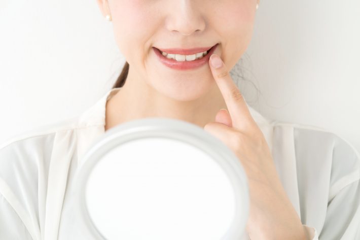 八重歯も、そばかすも消したのに