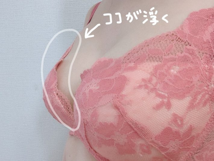 カップ上辺浮き