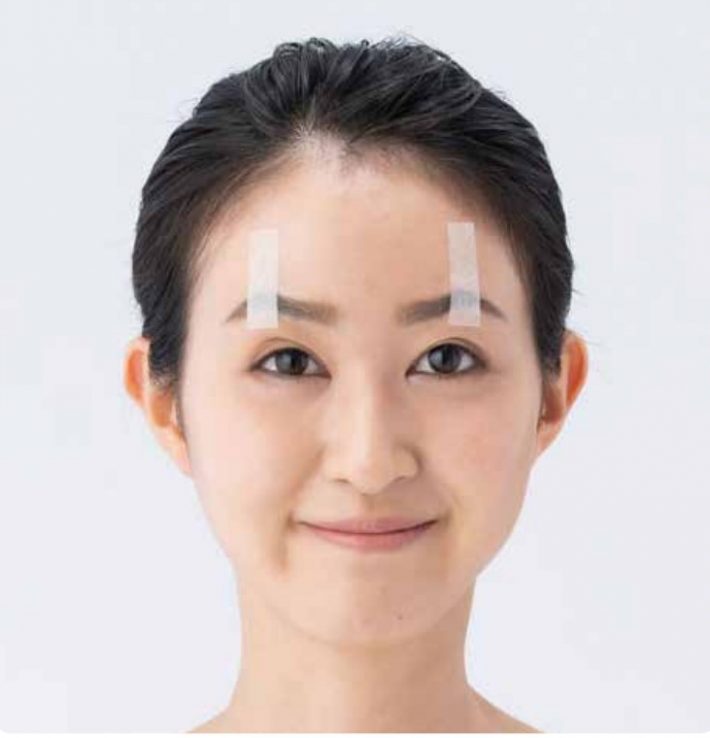 松尾清『名医が教える「まぶたテープ」』より