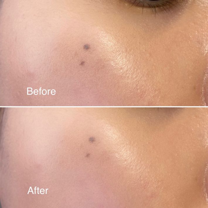 肌全体がフラットに整えてくれる