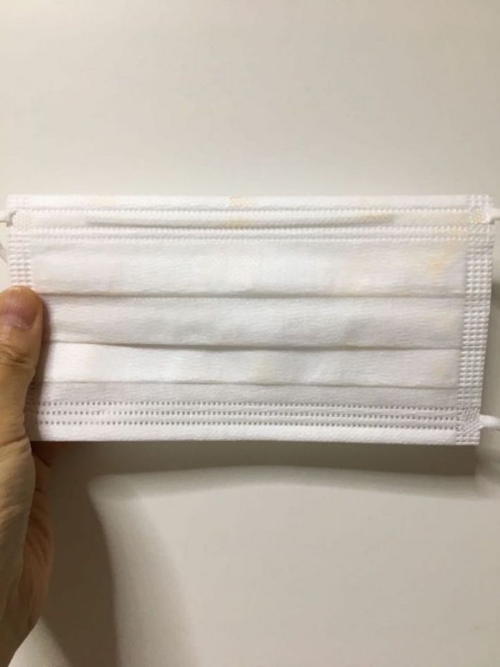 パウダーを付けた左もほぼ綺麗でした