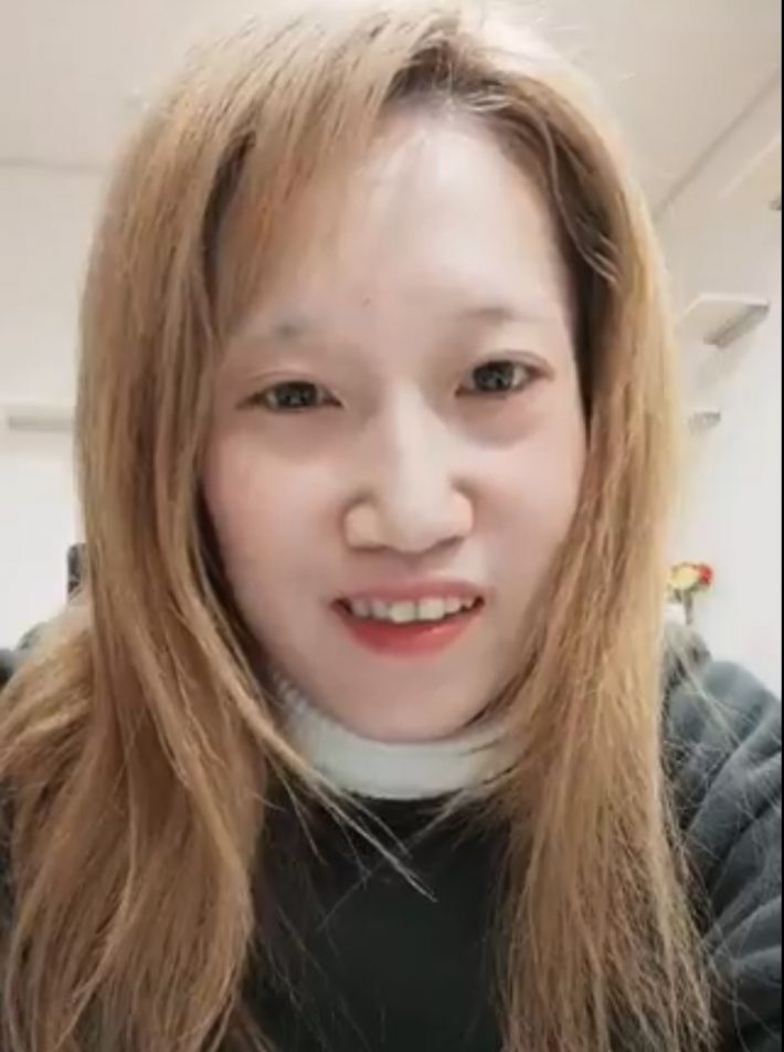 ステロイドのおかげか、少し顔のこわばりが解消された