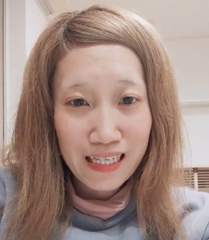 発症から6週間くらい。口元は少し気になるが、ここまで回復できたことに感謝