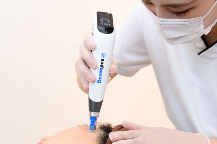 ダーマペンの口は、細い針の剣山みたいになっている